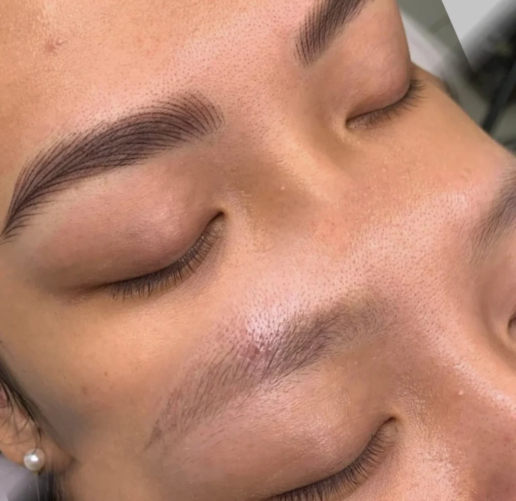 cosmetic tattoo risk