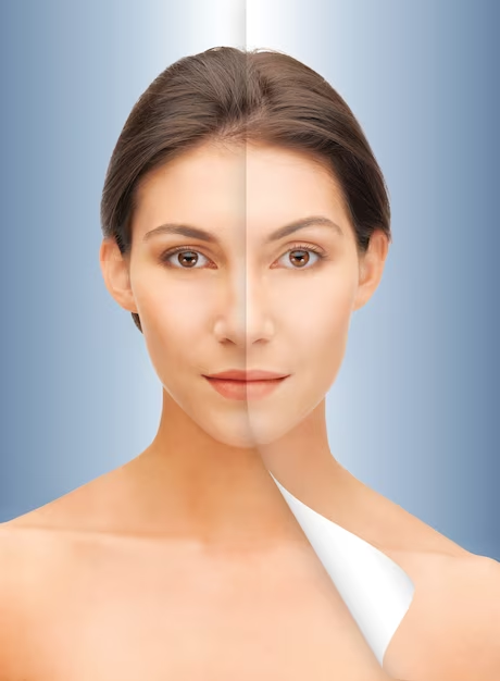 bio remodelling injections