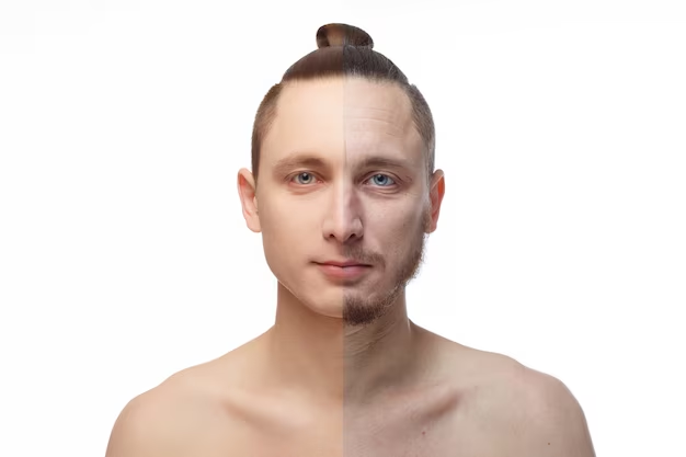 bio remodelling injections before and after