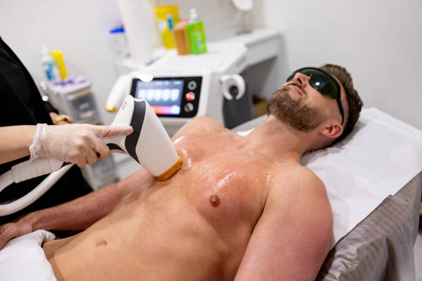 contraindications to laser hair removal